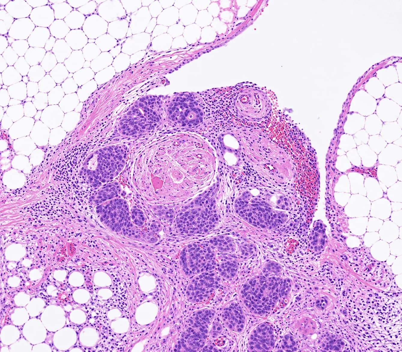 Detalle de una muestra histológica al microscopio