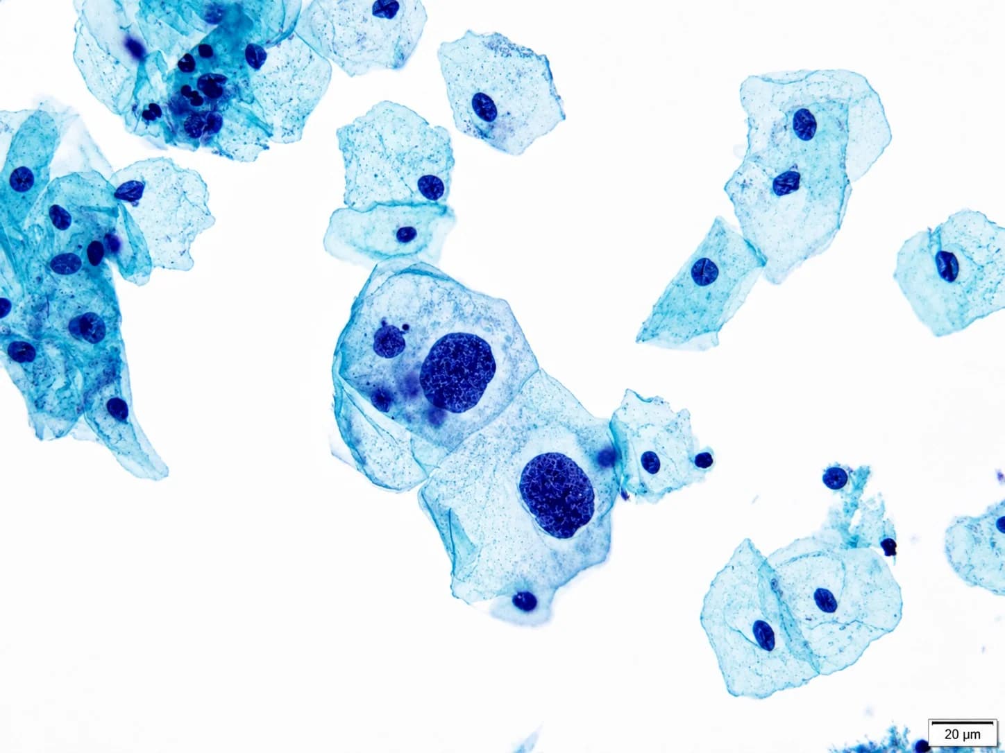 Extendido citológico con células teñidas en azul visto al microscopio
