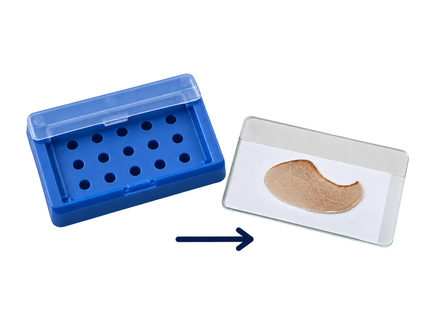 Casete de inclusión y bloque de parafina con el tejido incluido